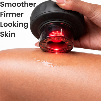 LumaCup Smart Cupping Massager